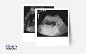 Bump 2 Baby & Beyond Diagnostic Firm Leaks Fetal Ultrasounds Bump 2 Baby & Beyond Diagnostic Firm Leaks Fetal Ultrasounds