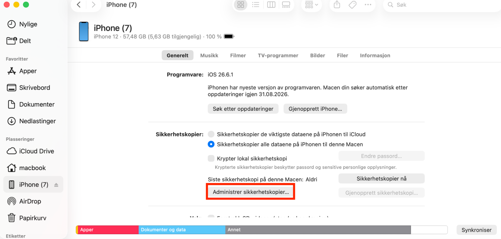 Knappen Administrer sikkerhetskopier for å begynne å fjerne iOS-sikkerhetskopier